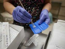 Cerita Dokter Forensik Tak Nyaman karena Ada Prasangka Kasus Brigadir J