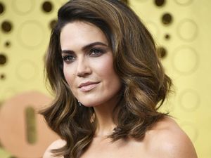Mandy Moore Cerita Putranya Berusia 2 Tahun Idap Sindrom Gianotti-Crosti