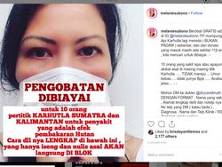 Lewat Instagram, Melanie Subono Buka Pengobatan Gratis Akibat Karhutla