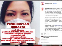 Lewat Instagram, Melanie Subono Buka Pengobatan Gratis Akibat Karhutla