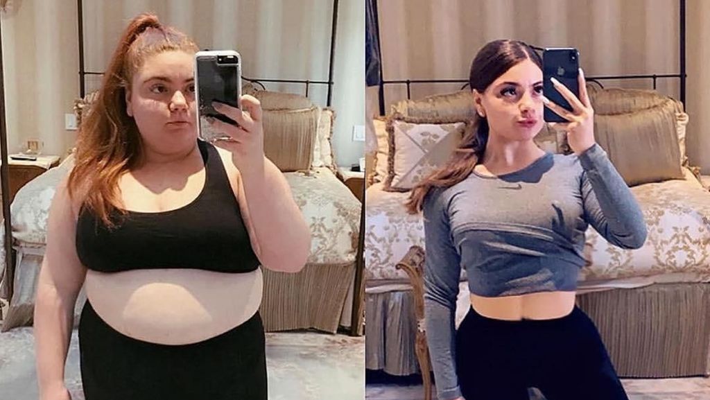 Foto: Before-After Wanita yang Tadinya Berbobot 107 Kg Jadi 50 Kg Foto: Before-After Wanita yang Tadinya Berbobot 107 Kg Jadi 50 Kg