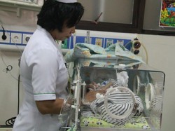 Kondisi Menurun, Bayi Berkaki dan Bertangan Empat di Bali Meninggal