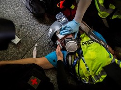 Kena Peluru Karet, Jurnalis Indonesia Tuntut Jawaban dari Polisi Hong Kong