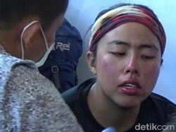 Wajah Pendaki Gunung Raung yang Selamat Melepuh karena Menerjang Api