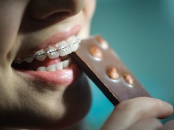 Memakai Behel dan Rambut Sambung, Apakah Harus Dicopot saat Meninggal Dunia?