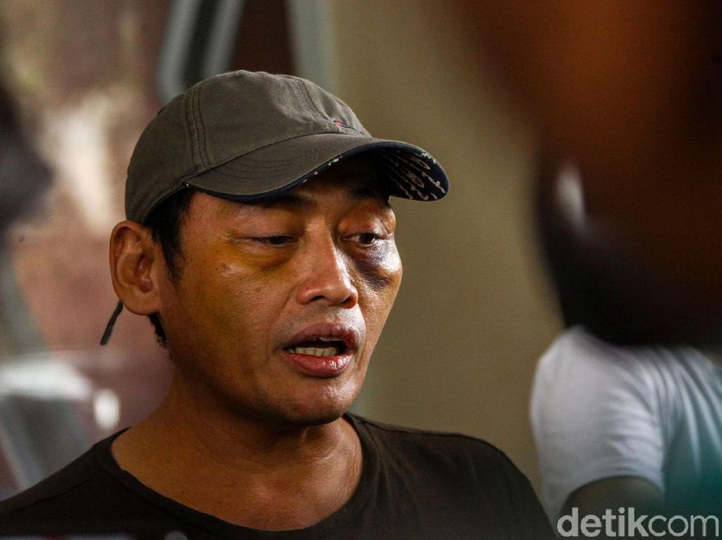 Total Ada 3 Tersangka Perempuan di Penculikan Ninoy Karundeng, Ini Perannya Total Ada 3 Tersangka Perempuan di Penculikan Ninoy Karundeng, Ini Perannya