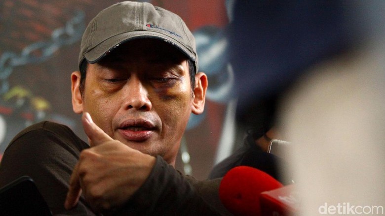 Keterangannya Diragukan PA 212, Ninoy Karundeng: Saya Kenali Muka