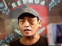 Bantah Ninoy soal Sosok Habib, Pengacara Tersangka: Itu Hanya Istilah