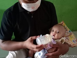 Derita Penyakit Jantung Sejak Lahir, Bayi Kamila Butuh Uluran Tangan