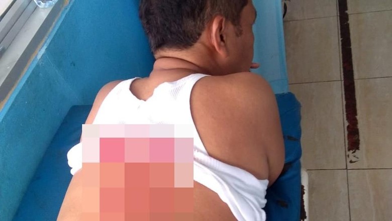 Kondisi Kapolsek Menes yang Ikut Ditusuk Bersama Wiranto Stabil