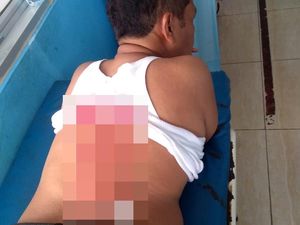 Kondisi Kapolsek Menes yang Ikut Ditusuk Bersama Wiranto Stabil