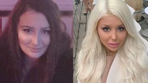 Penampilan Gadis Swedia Sebelum dan Setelah Terobsesi Jadi Barbie