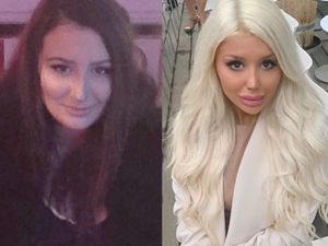 Penampilan Gadis Swedia Sebelum dan Setelah Terobsesi Jadi Barbie