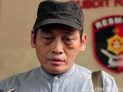 Tersangka RF: Sosok Habib Ikut Pukul dan Tendang Ninoy Karundeng