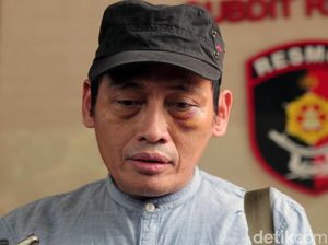 Beberkan Peran dr Insani, Ninoy Karundeng: Dia Tak Obati Saya Beberkan Peran dr Insani, Ninoy Karundeng: Dia Tak Obati Saya