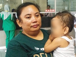 Sekujur Tubuh Melepuh, Istri yang Dibakar Suami Dirujuk ke RSU Soetomo