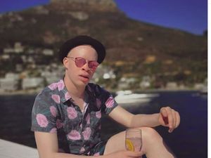 Potret Liburannya Model Albino, Sanele Junior Xaba