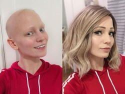 Sering Gonta-ganti Gaya Rambut, Wanita Cantik Ini Ternyata Botak