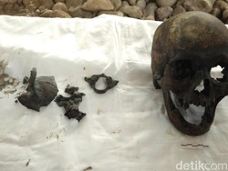 Ahli Forensik Gigi Unpad Teliti Tengkorak Misterius di Indramayu