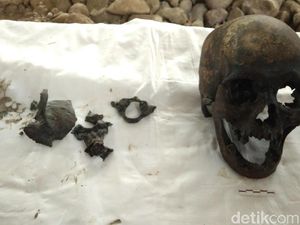 Ahli Forensik Gigi Unpad Teliti Tengkorak Misterius di Indramayu Ahli Forensik Gigi Unpad Teliti Tengkorak Misterius di Indramayu