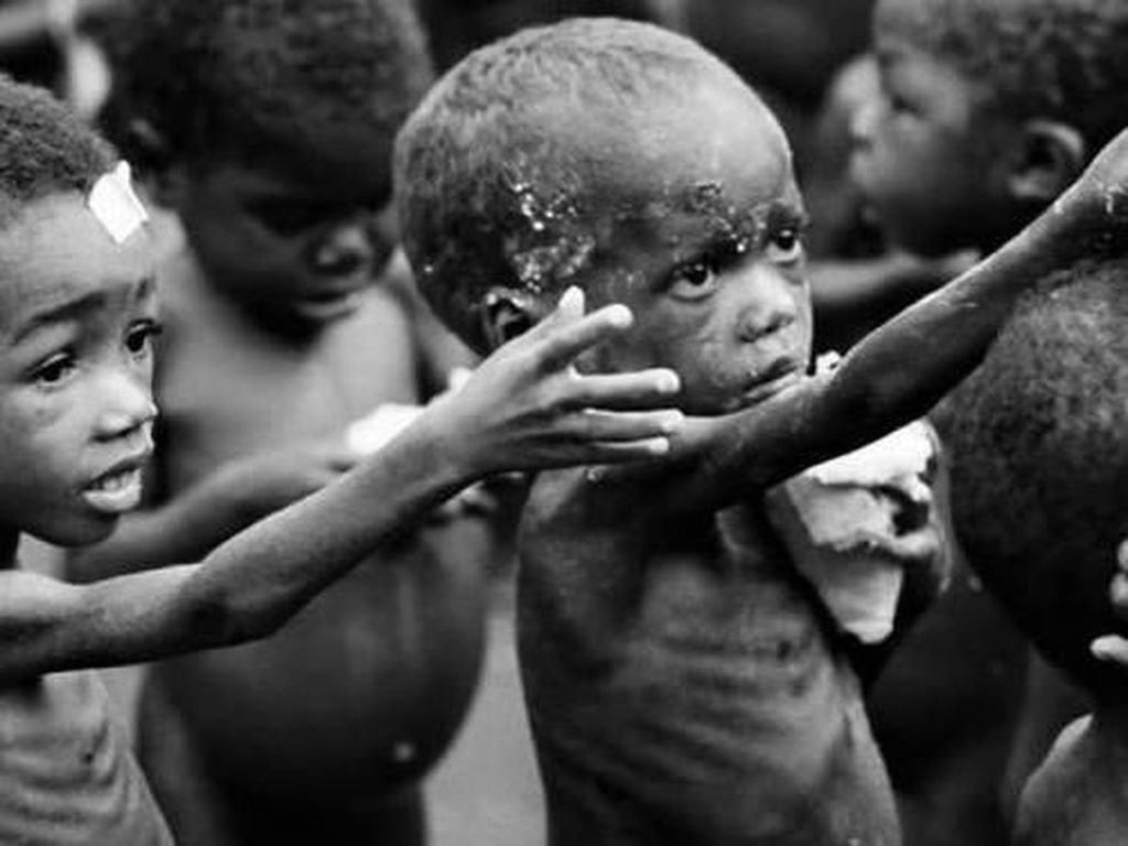 Potret Kelaparan dan Gizi Buruk di Hari Pangan Sedunia 2020