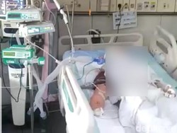 Motif Suami yang Bakar Istri di Surabaya Diduga Cemburu