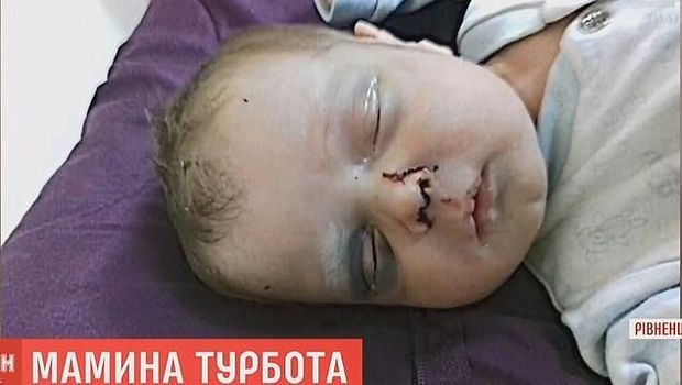 Mykyta, bayi dipukuli di Ukraina