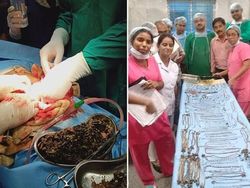 Para Dokter Ini Kaget Temukan Ular hingga Belut Hidup di Perut Pasien