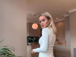 Wanita Ini Menyesal Operasi Plastik Bokong Murahan, Bentuknya Jadi Tak Alami