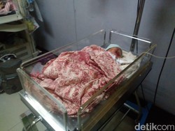 Miris, Bayi Penuh Luka Ditemukan di Pemakaman Dusun Krajan Karawang