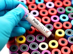 Heboh Jadi KLB di RI, Polio Menular atau Tidak Sih? Ini Faktanya