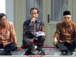 Dikaitkan dengan Posisi Duduk Jokowi yang Viral, Apa Itu Hyperlaxity?