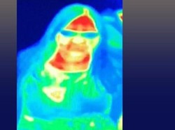 Cerita Turis yang Beruntung Kanker Payudaranya Terdeteksi Kamera Museum