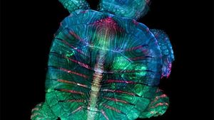 Foto Menakjubkan Pemenang Kontes Dunia Mikroskopis