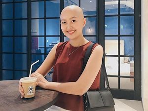 Kecenya Kulineran Nadya Valerie, Pejuang Kanker yang Pede Berkepala Botak