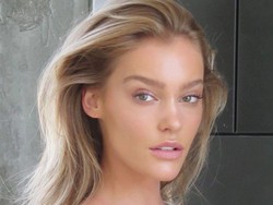 Model Habiskan Rp 210 Juta untuk Atasi Jerawat, Sembuh dengan Obat Herbal