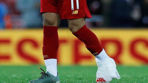 Duh, Salah Cedera Lagi