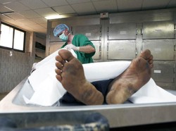 5 Makanan Ini Mirip Bagian Tubuh Orang Mati yang Diotopsi