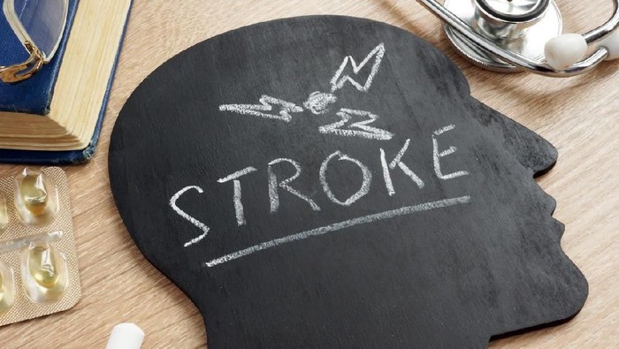 Gaya hidup tidak sehat merupakan faktor risiko stroke (Foto: iStock) Gaya hidup tidak sehat merupakan faktor risiko stroke (Foto: iStock)
