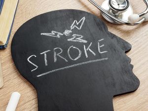 Apakah Stroke Ringan Bisa Sembuh? Begini Kata Dokter Jantung Apakah Stroke Ringan Bisa Sembuh? Begini Kata Dokter Jantung