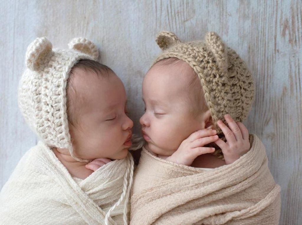 Bayi Kembar Laki-Laki Terkecil di Dunia Lahir Hanya Berbobot 450 Gram