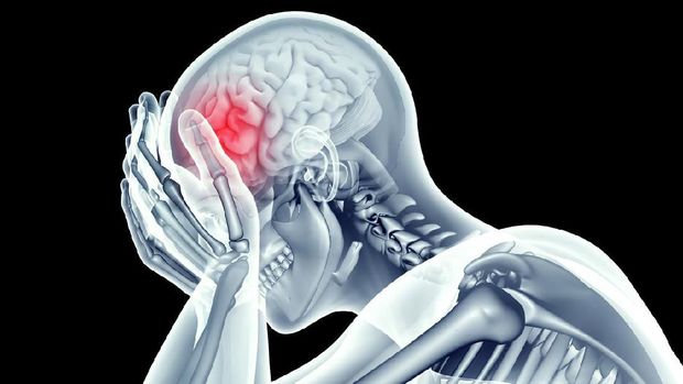 x-ray image human head with headache pain