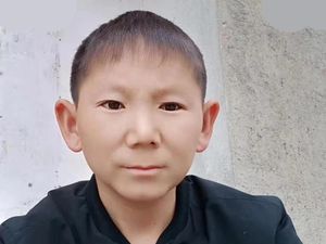 Cedera Kepala Saat Kecil Bikin Pria 34 Tahun Jadi Berwajah Anak-anak