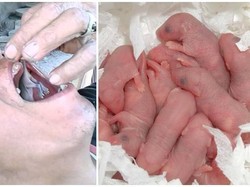 Makan Undur-undur hingga Bayi Tikus, Ini 5 Tradisi Pengobatan Unik