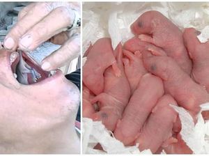 Makan Undur-undur hingga Bayi Tikus, Ini 5 Tradisi Pengobatan Unik Makan Undur-undur hingga Bayi Tikus, Ini 5 Tradisi Pengobatan Unik