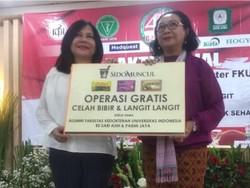 27 Anak Penderita Celah Bibir dan Langit-langit Dapat Operasi Gratis