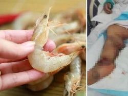 Waduh! 5 Orang Ini Tewas Setelah Menyantap Ikan hingga Kepiting