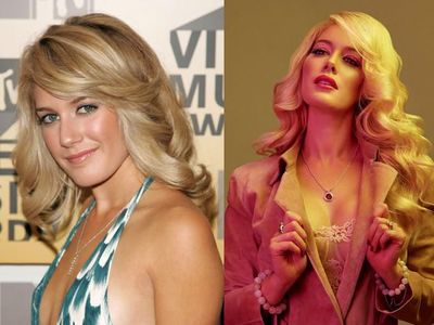 Deretan Selebriti yang Pernah Ngaku Operasi Plastik