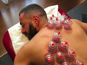 Ramai Foto Karim Benzema Bekam, Efektifkah Mencegah Penyakit? Ramai Foto Karim Benzema Bekam, Efektifkah Mencegah Penyakit?