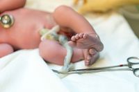 Cara Tepat Merawat Tali Pusar Bayi Baru Lahir